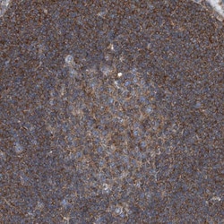 Septin-7 Antibody, Novus Biologicals 0.1mL; Unlabeled:Antibodies